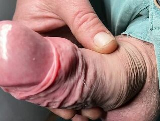 Foreskin close up completing with popshot